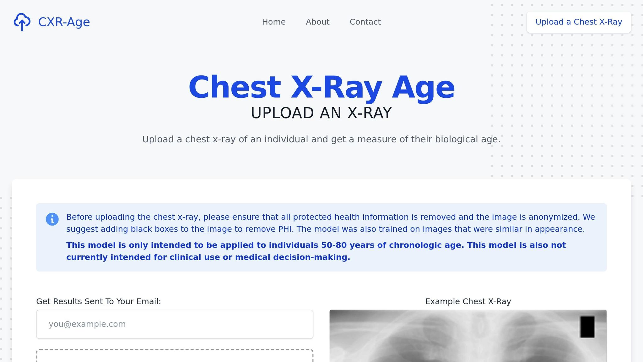 CXR-Age