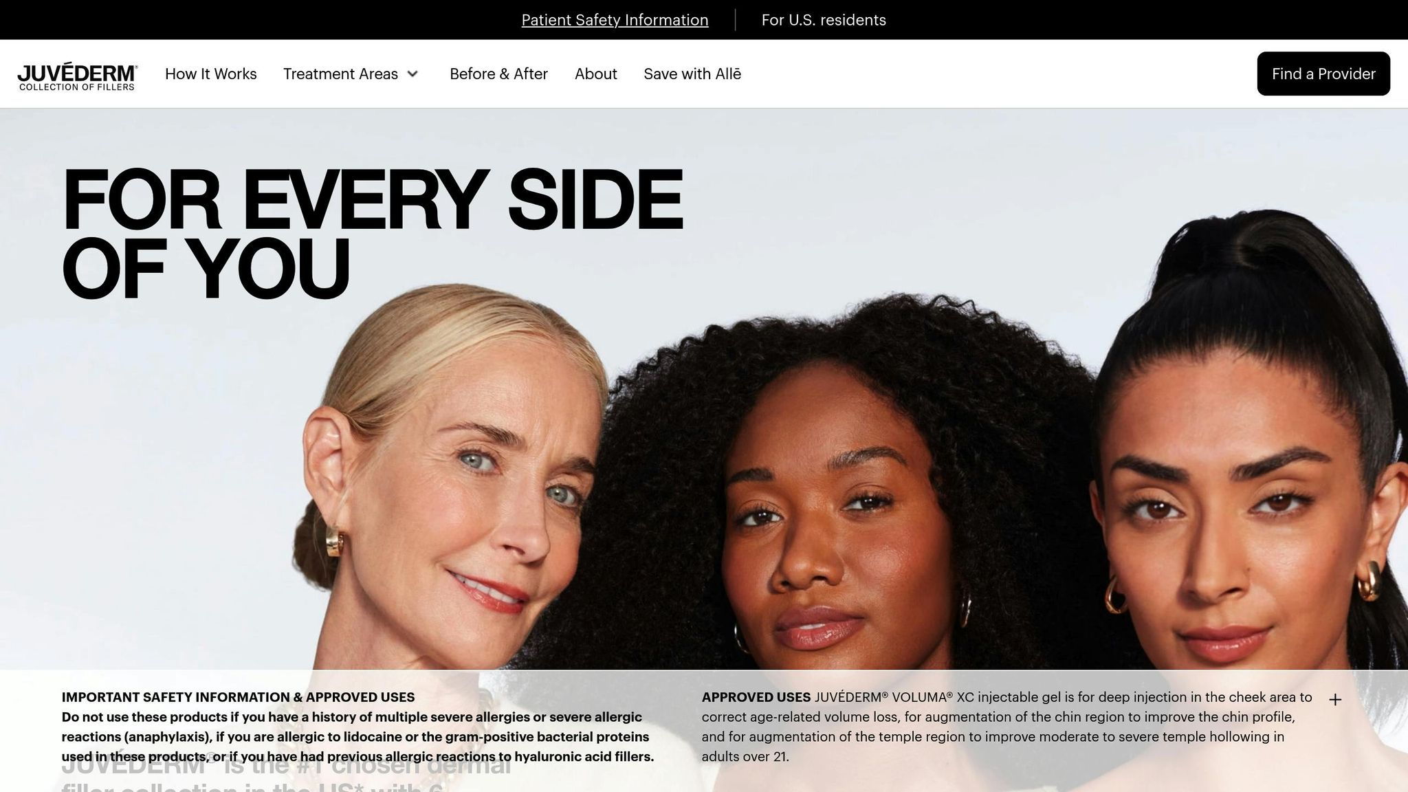Juvederm Voluma XC