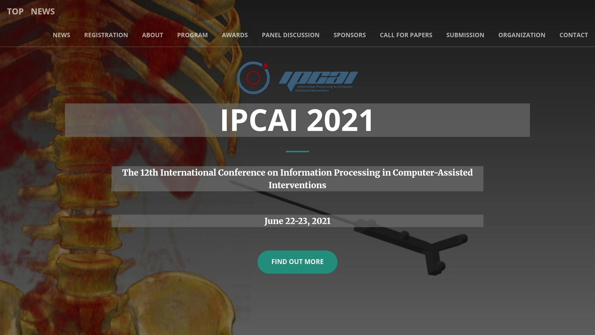 IPCAI 2021