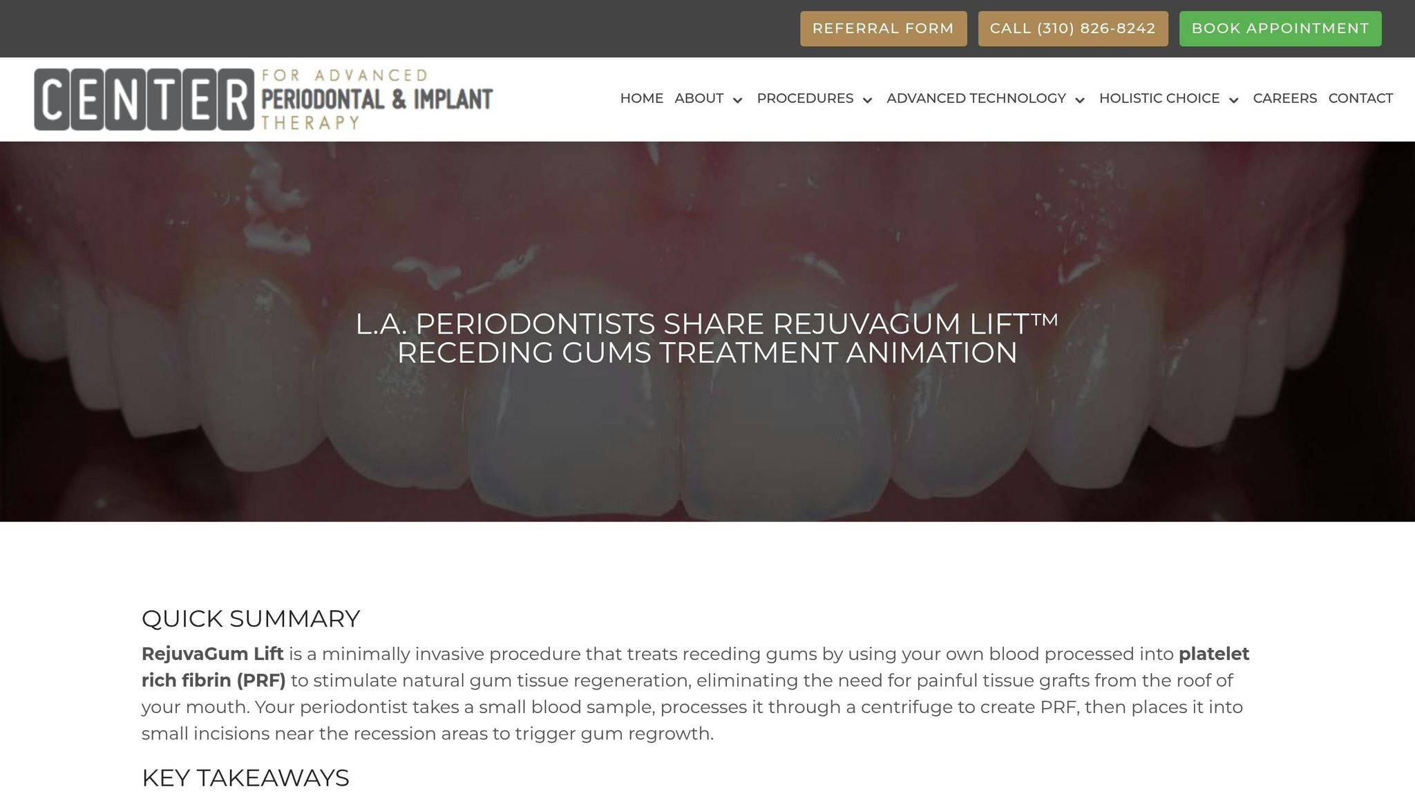 RejuvaGum Lift