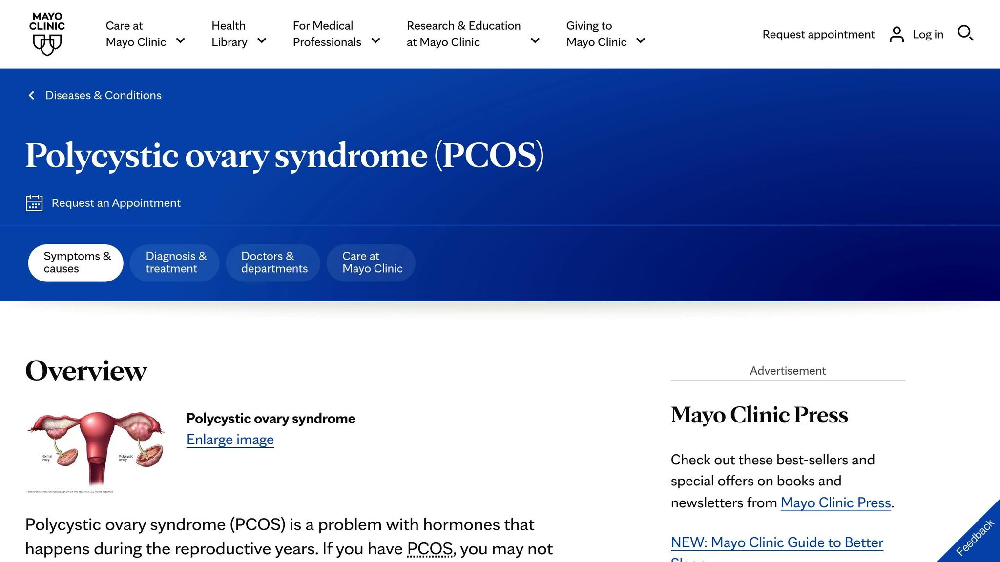 PCOS