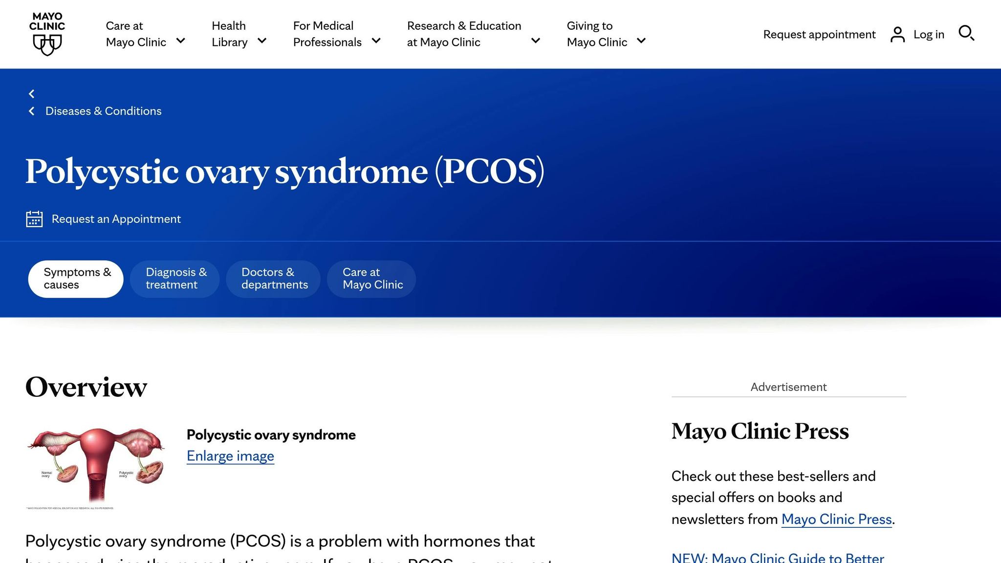 Polycystic Ovary Syndrome
