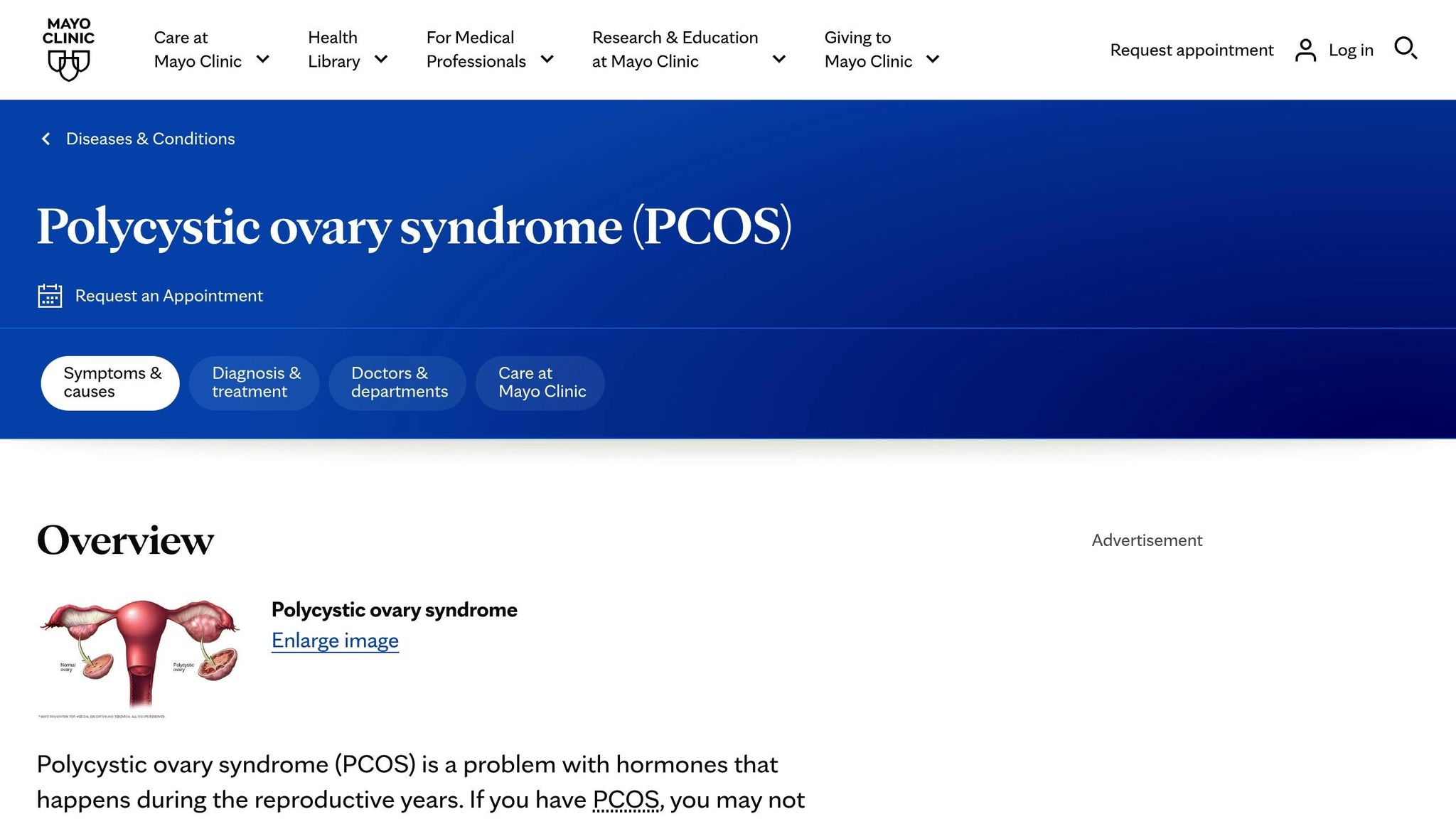 PCOS